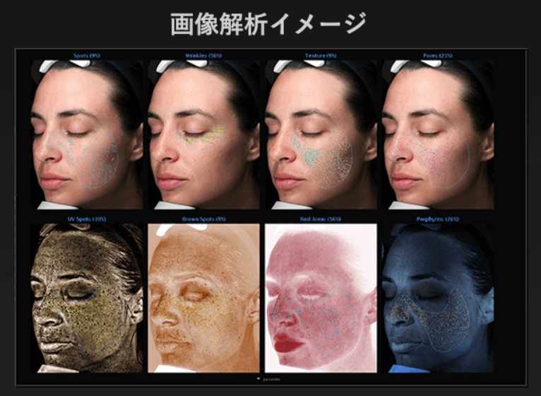 アリシアネオクリニック顔の皮膚画像解析システム2