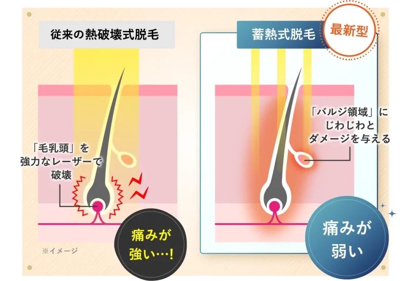 メンズミラクリニック痛みが少ない